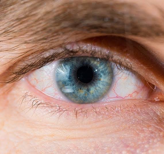 General Eye Care